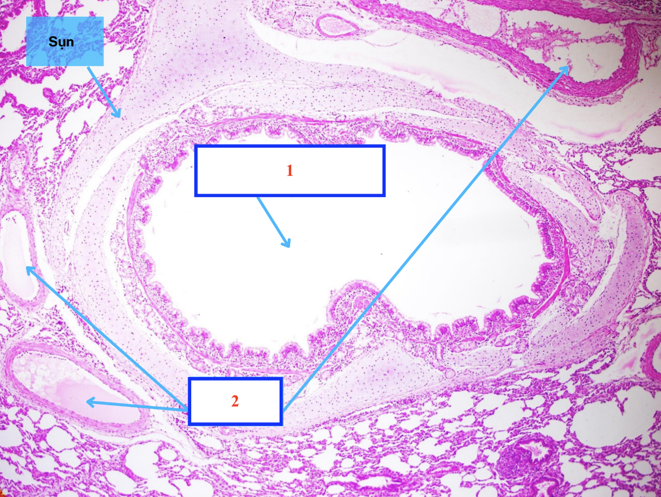 <p>Cấu trúc gì ?</p>