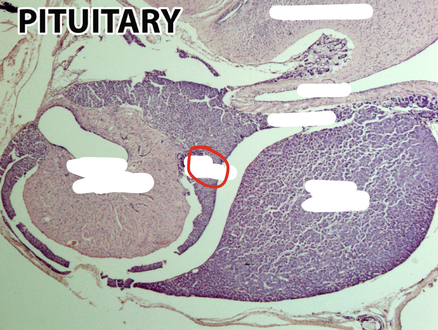 <p>What part of the pituitary is this?</p>
