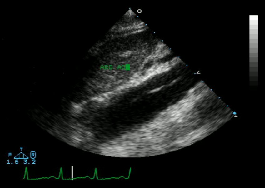 <p>This is an an example of ?</p>