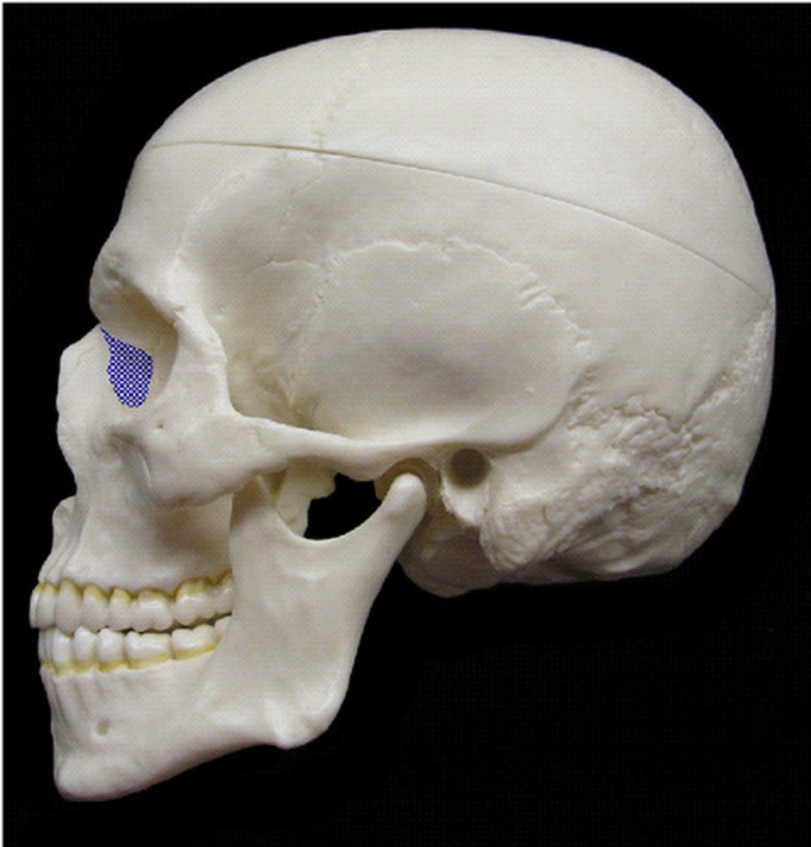 <p>ID highlighted bone</p>