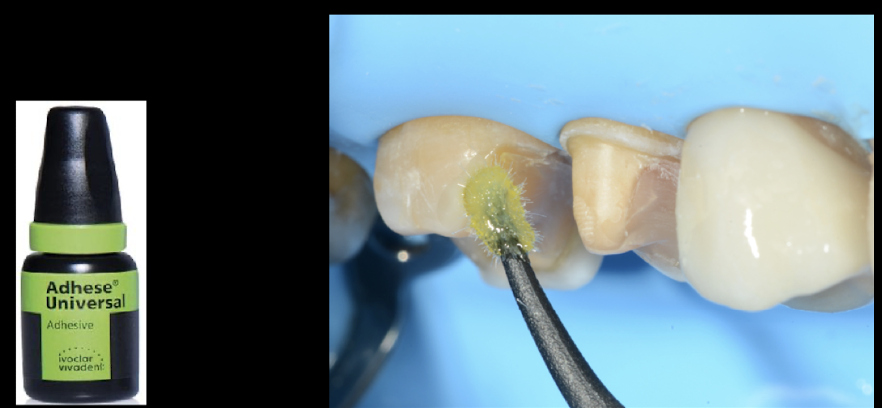 <p>bonding application protocol for adhese universal </p>