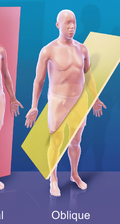 <p>oblique</p>