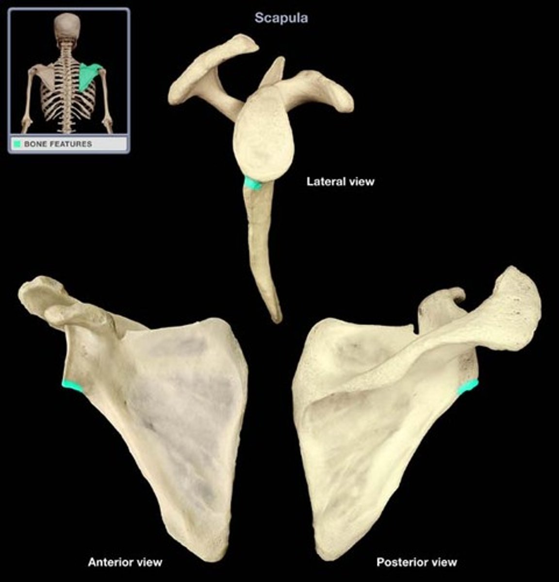 <p>long head of triceps brachii origin</p>