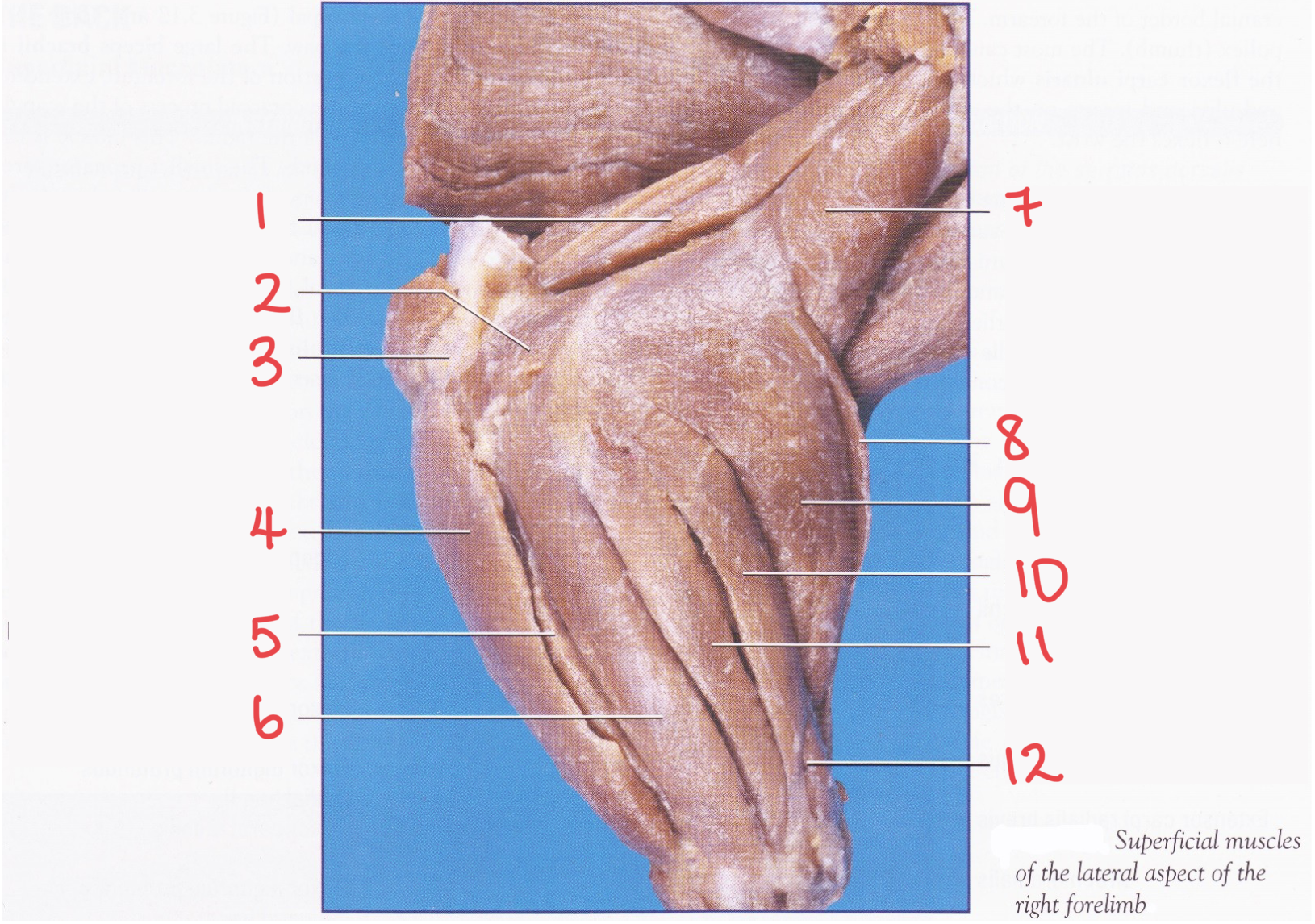<p>Name muscle #10</p>