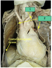 <p>What nerve is shown at #1?</p>