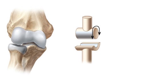 <p>-Convex bone fits INTO concave bone</p><p>-monoaxial</p><p>-joint btw humerus and ulna</p>