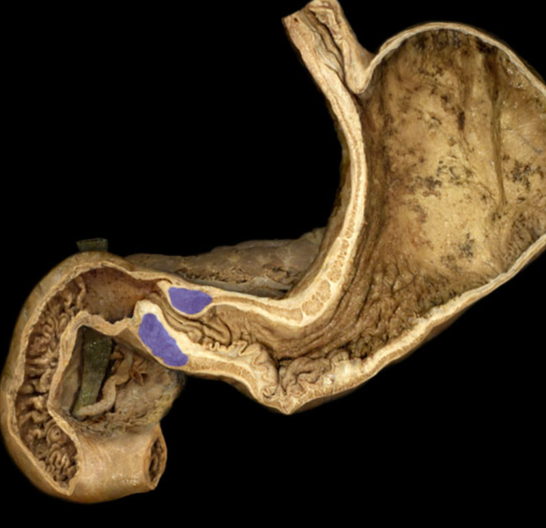 <p>ID this muscle </p>