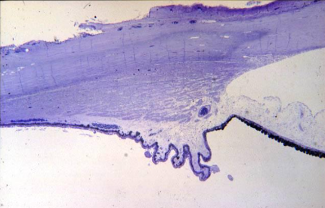 <p>ciliary muscle structure labels </p>