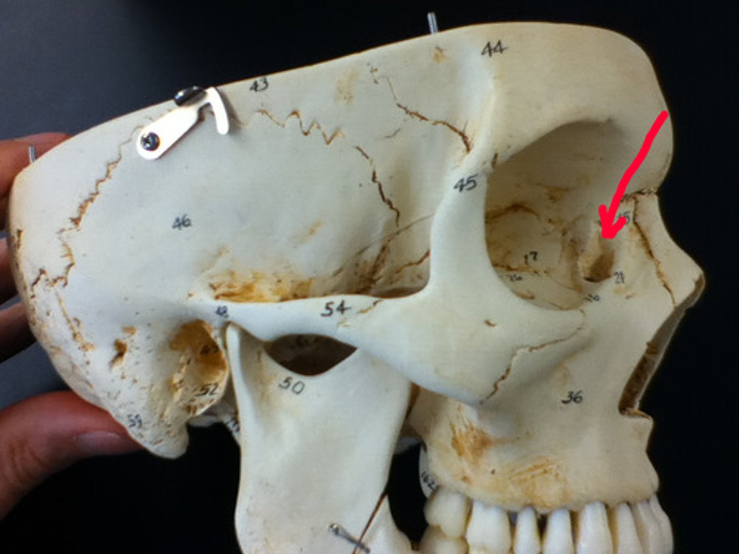 <p>tear DUCT</p>