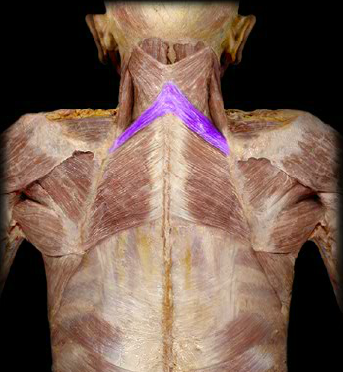 <p>What is this superficial muscle (highlighted)?</p>