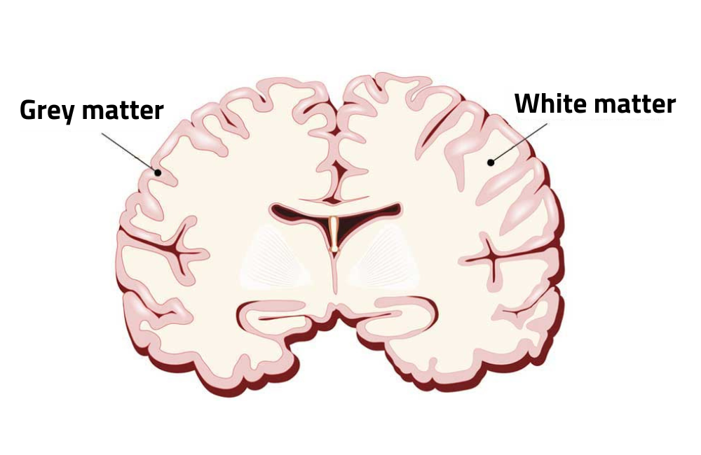 <p>language, cog, memory, conciousness</p><p>cerebral cortext: receives input from sensory organs and somatosensory organs</p><p>grey matter: neuron cell bodies, process data, memory thoughts</p><p>white: axon, commuication network ofrom grey and rest of body</p>