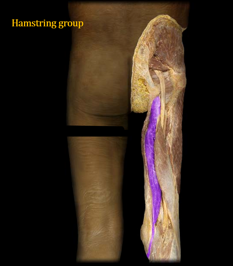 <p>What muscle is this?</p>