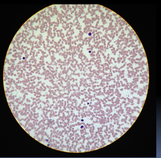 <p>Blood (location and function)</p>