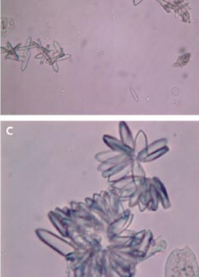 <p>what crystal is this? acid or alk?</p>