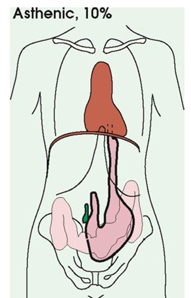 <p>very slender (10%) build</p><p>-narrow thorax/chest</p><p>-long vertically</p>
