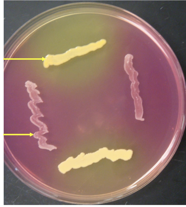 <p>what’s the selective agent?</p><p>only …. bacteria grow</p>