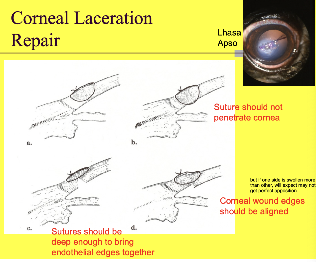 <p>Sutures should not penetrate cornea (don't want to penetrate into anterior chamber).</p><p>Corneal wound edges should align.</p><p>Sutures should be deep enough to bring endothelial edges together.</p>