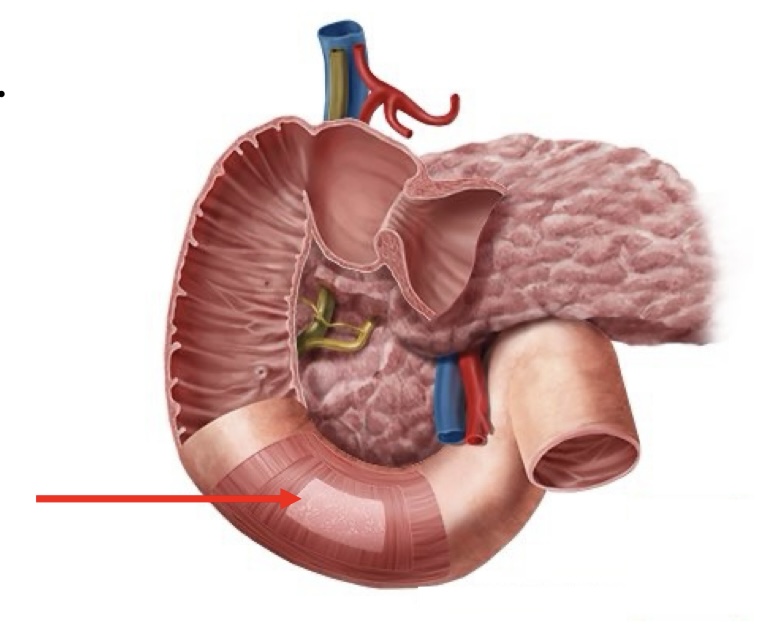 term image