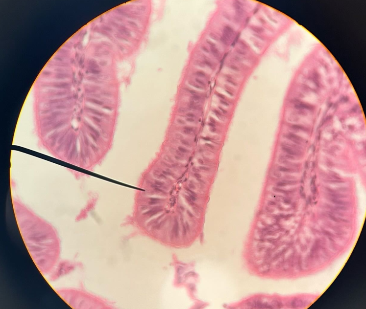 <p>ID tissue</p>
