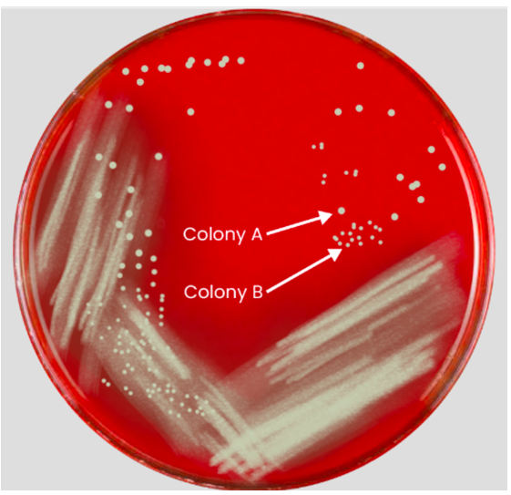 <p><span>Bacterial cells were detected in a patient’s CSF sample, so additional tests were ordered including culturing the CSF on blood agar. After examining the cultural characteristics of the colonies growing on the plate, you are concerned that more than one species may be present. Would a simple stain of each colony (A and B) be able to determine if there are two bacterial species growing on the blood agar plate?</span></p>