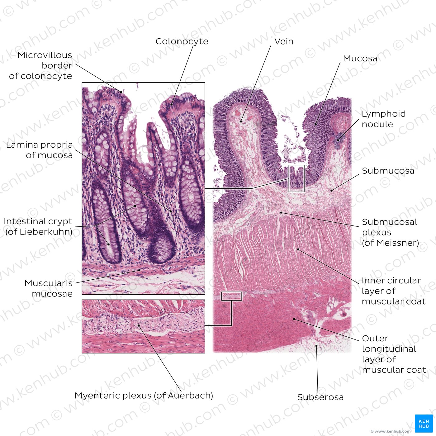<p>extra small intestine histology</p>