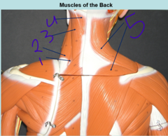 <p>muscles of the back 2 - #4</p>