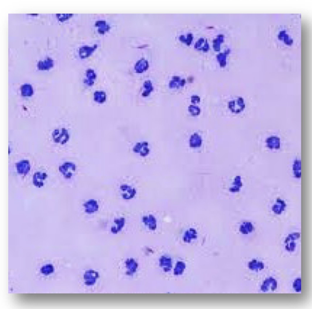 <p>is this cytology consistent with normal, inflammatory or noninflammatory joint disease?</p>