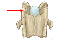 <p>Q: The 6th cervical vertebra (C6) possesses expanded sagittal platelike transverse processes called the …… </p><p>A. lamina ventralis </p><p>B. median sacral crest </p><p>C. interarcuate ligament </p><p>D. hemal arch</p>