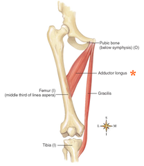 <p>linea aspera of femur</p>