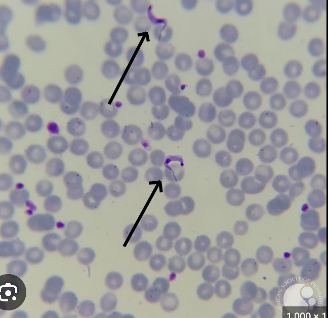 <p><span style="background-color: transparent; font-family: "Times New Roman", serif;">&nbsp;Trypanosoma Cruzi (like crucio)&nbsp; kissing bug</span></p>