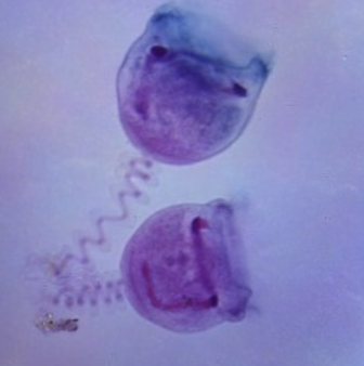 <p>(Phylum Ciliophora)</p>