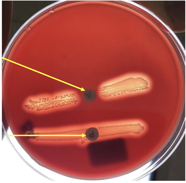 <p>what hemolysis is this?</p>