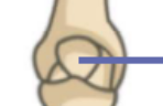 <p>What bone is this?</p>