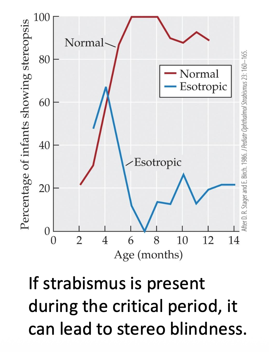 <p><u>Development of Binocular Vision: Stabismus</u></p><p><span style="color: rgb(255, 153, 0);">Strabismus: A misalignment of the two eyes such that a single object in space is imaged on the fovea of one eye, and on a __ of the other (turned) eye.</span></p><p><span style="color: rgb(255, 255, 255);">What are the 2 types of Strabismus?</span></p><p class="p1"><span style="color: rgb(98, 170, 250);">• Suppression: In vision, the __ of an unwanted image.</span></p><p class="p1"><span style="color: rgb(81, 255, 0);">• __ blindness</span></p>
