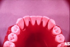 <p>Junction of two surfaces</p>