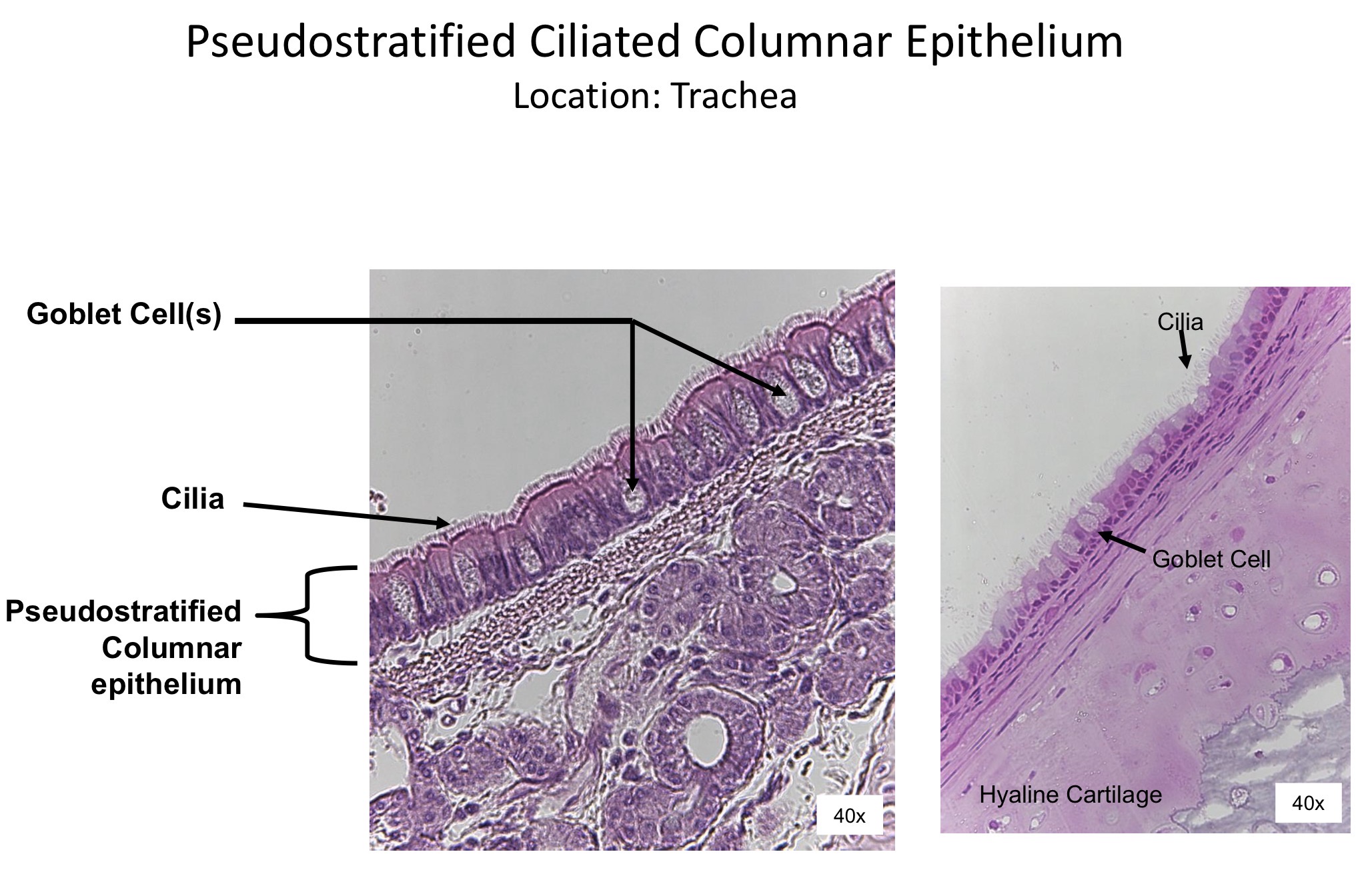 <ol><li><p>Goblet cells </p></li><li><p>Cilia </p></li><li><p>Pseudostratified columnar epithelium </p></li><li><p>Cilia</p></li><li><p>Goblet cell </p></li><li><p>Hyaline cartilage </p></li></ol><p></p>