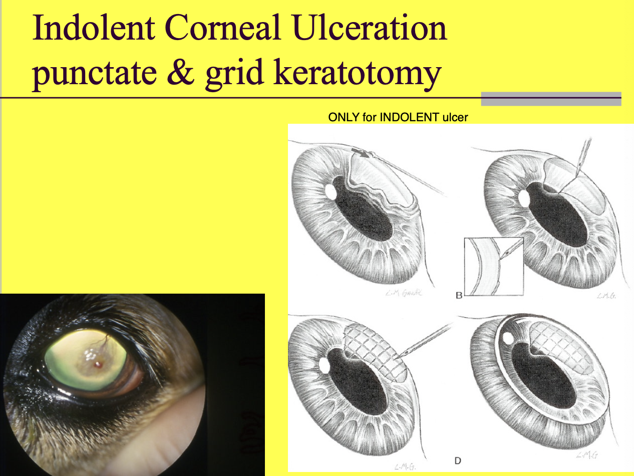 <p>Considerations for Punctate and grid keratotomy or Burr keratotomy (2)</p>