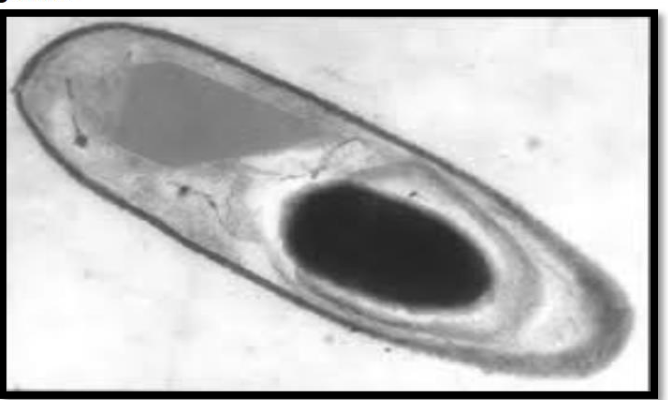 <p><span style="font-size: medium;">Bacillus thuringiensis</span></p><p>a. is used commercially to synthesize ethanol</p><p>b. causes crown gall in plants</p><p>c. produces a natural insecticide toxic to insects</p><p>d. is a nitrogen fixing bacterium</p>