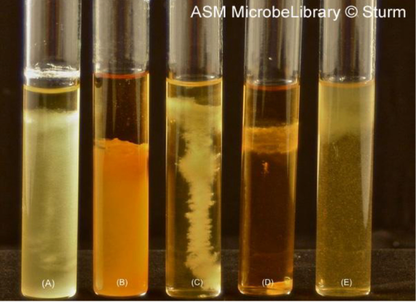 <p>In the thioglycolate broth, where would you expect to see growth of a strict anaerobe? </p>
