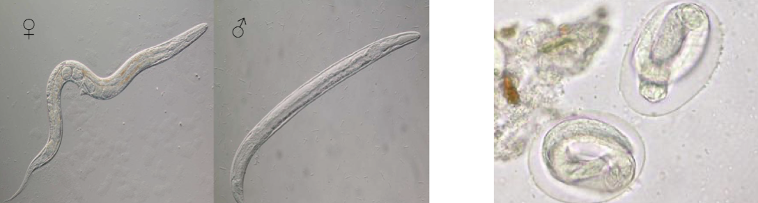 <ul><li><p>adult and egg form </p></li><li><p>threadworm </p></li><li><p>causes <span>Strongyloidiasis</span></p></li></ul><p></p>
