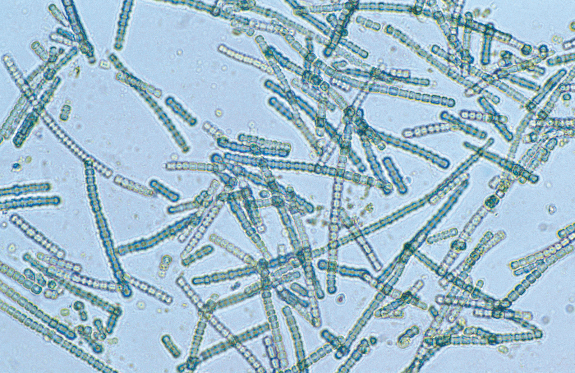 <p>cyanobacteria </p>
