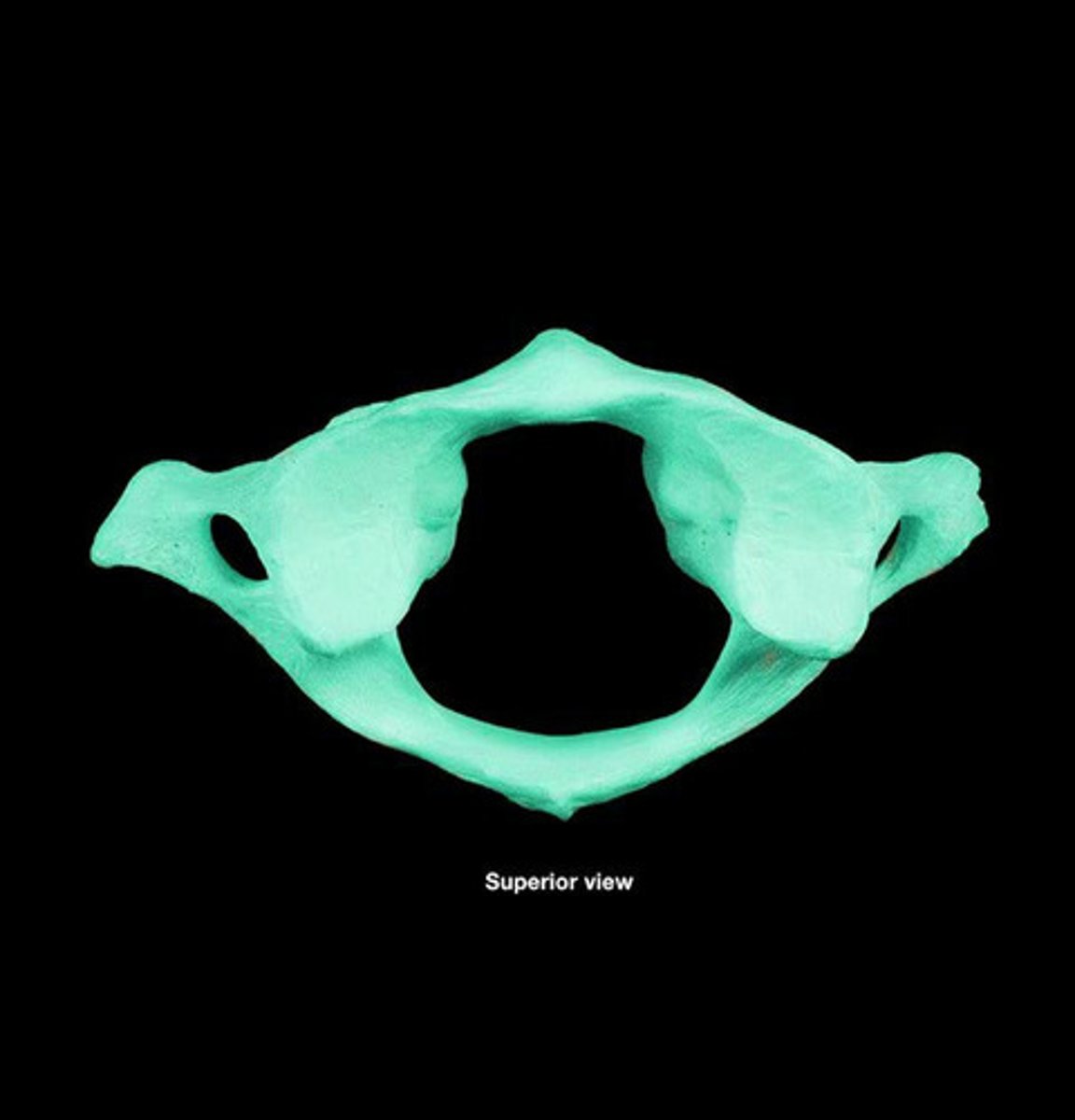 <p>first cervical vertebra (C1), jointed with the occipital bone allowing the head to nod</p>