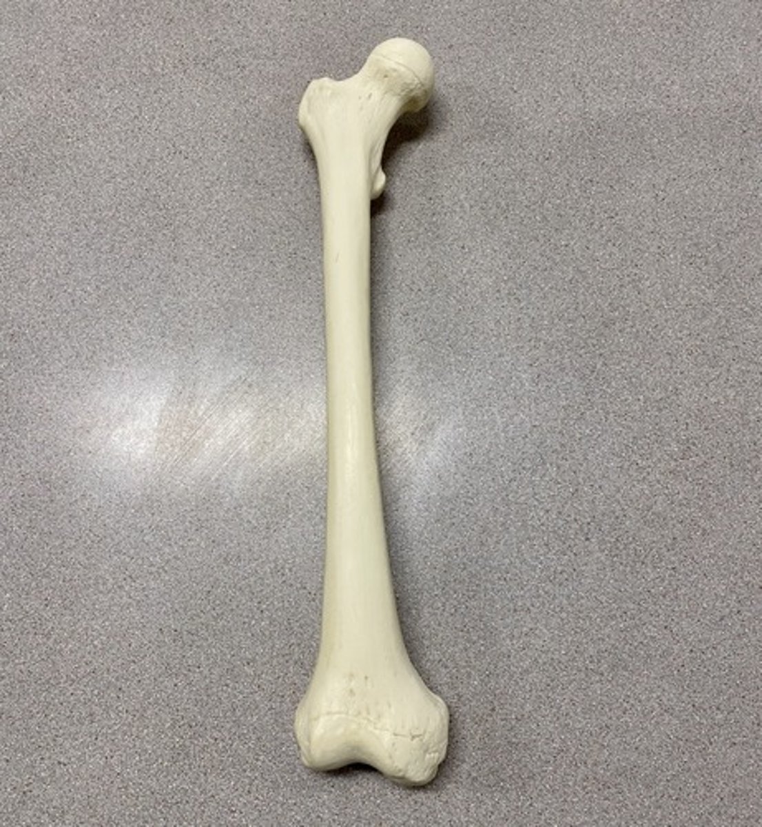 <p>What bone is this?</p>