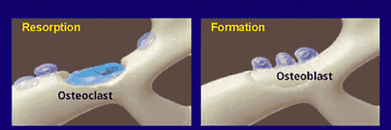 <p>Bone Remodeling</p>