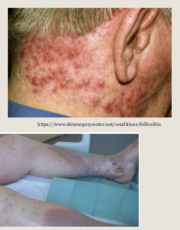 <p>whats this caused by</p>