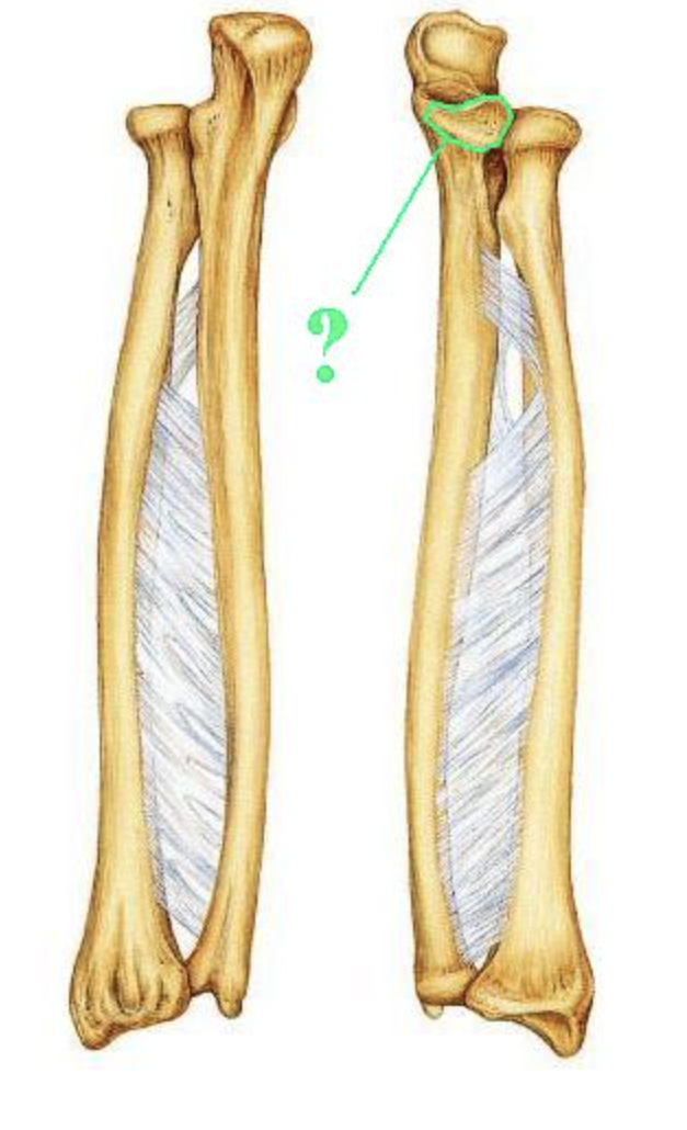 <p><span>Identify the indicated bone marking (projection).</span></p>