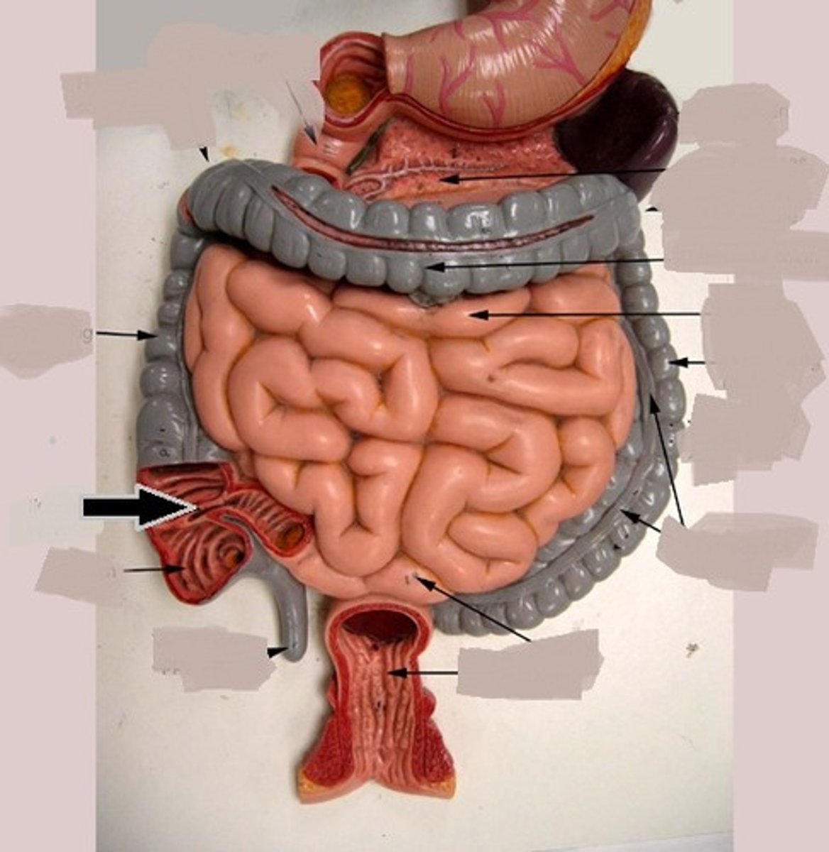 <p>little hole inside the large intestine</p>