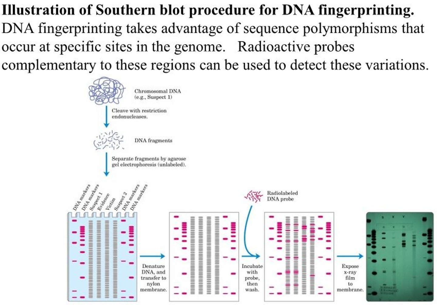 <p>The detection of RFLPs relies on a specialized hybridization procedure called Southern blotting. DNA fragments from digestion of genomic DNA by restriction endonucleases are separated by size electrophoretically, denatured by soaking the agarose gel in alkali, and then blotted onto a nylon membrane to reproduce the distribution of fragments in the gel. The membrane is immersed in a solution containing a radioactively labeled DNA probe. A probe for a sequence that is repeated several times in the human genome generally identifies a few of the thousands of DNA fragments generated when the human genome is digested with a restriction endonuclease. Autoradiography reveals the fragments to which the probe hybridizes.</p>