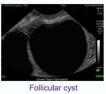 <p>thin walled, less than 3 mm thick</p><p>several large cyst or multiple small cysts</p><p>produces estrogen </p>