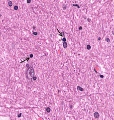 <p>How would you describe the nucleous of the indicated cells compared to others?</p>